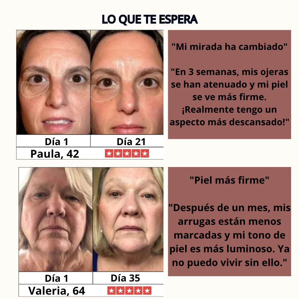 DermaWave™ Antiarrugas 7-en-1 - Resultados clínicos en casa.