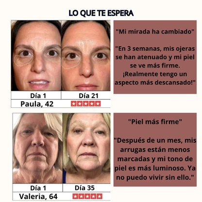 DermaWave™ Antiarrugas 7-en-1 - Resultados clínicos en casa.