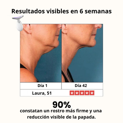 DermaWave™ Antiarrugas 7-en-1 - Resultados clínicos en casa.
